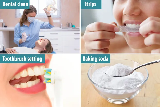 Common Teeth Whitening Myths