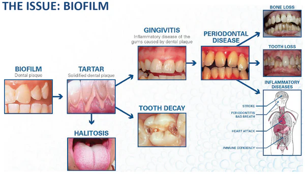 The Issue: Biofilm