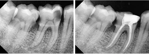 Emergency Dental Care