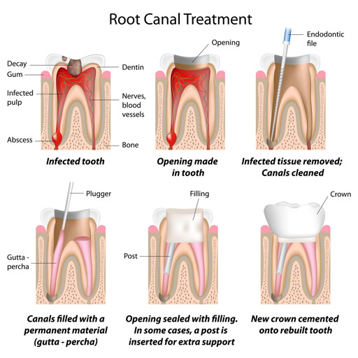 Emergency Dental Care