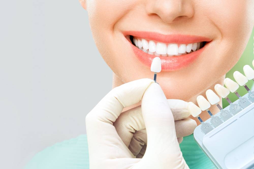 Teeth Whitening In Delhi