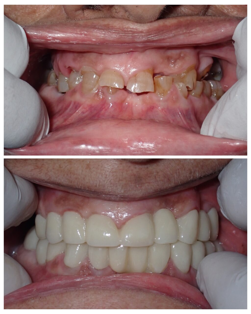 Dental Treatment Before After