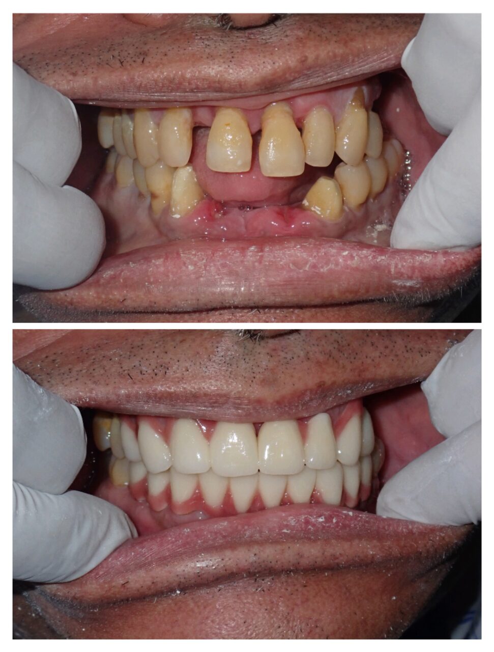 Dental Treatments Before After