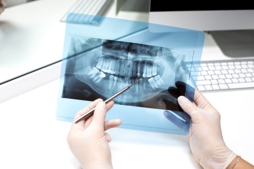 Dentist Analyzes X Ray