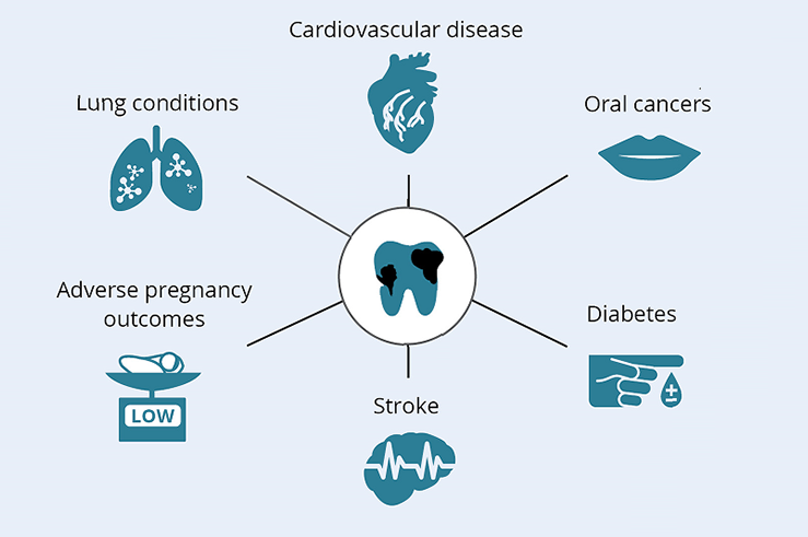 Oral Systemic