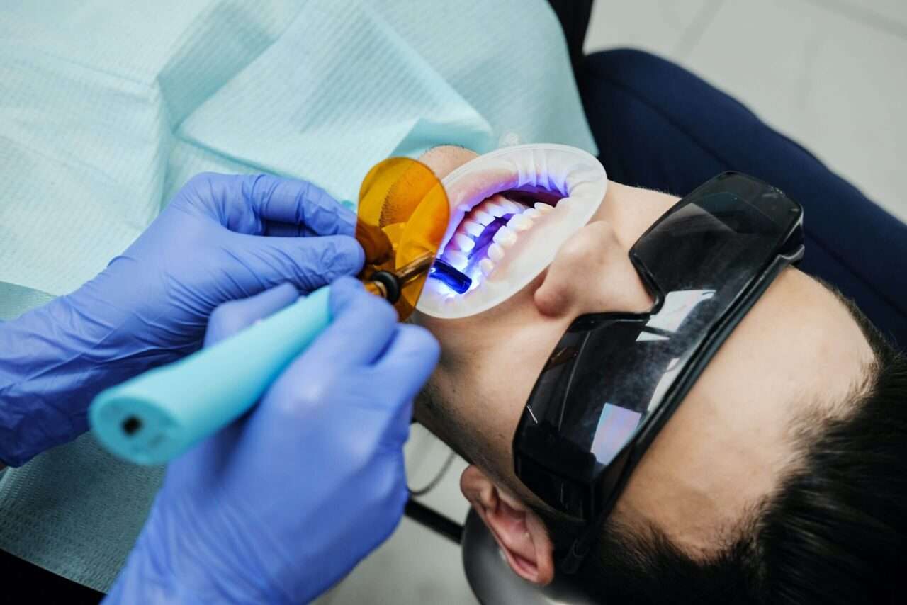 Teeth Whitening In Delhi