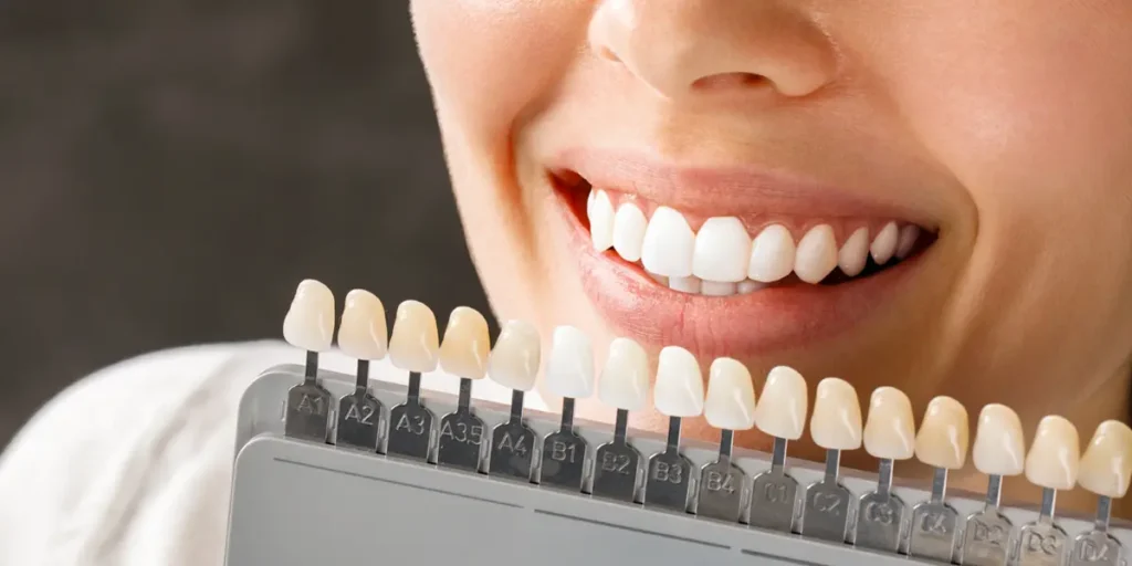 Teeth Whitening In Delhi