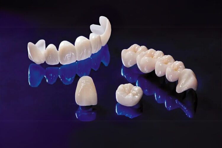 Why All Ceramic Crowns Are Gold Standard For Aesthetics