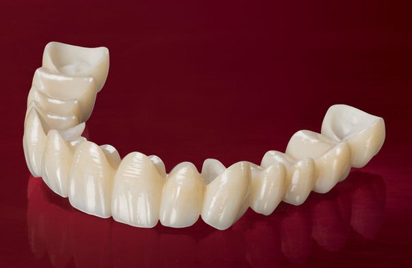 All Ceramic Crowns