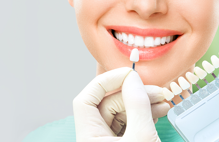 Cosmetic Dental Procedures