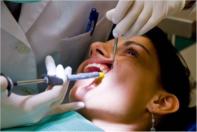 Painless Root Canal Treatment