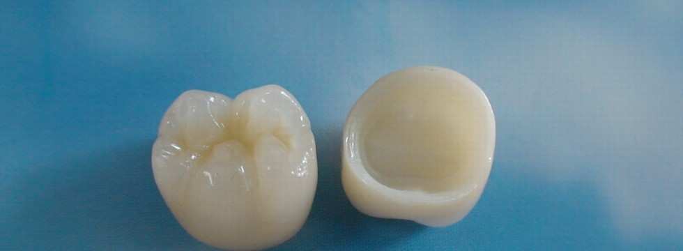 Zirconia Crowns