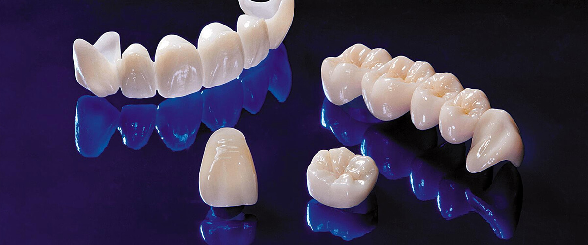 Types Of All Ceramic Crowns