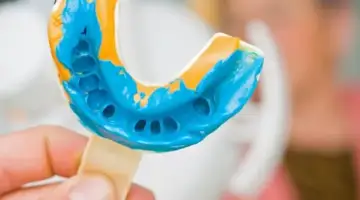 The Process What To Expect Blog Thumbnail