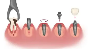 Month By Month Blog Thumb