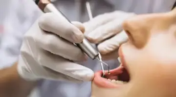 Preserving Natural Teeth Blog Thumbnail