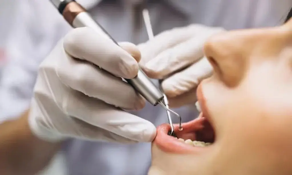 Preserving Natural Teeth Blog Thumbnail