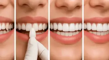 Step By Step Blog Thumb