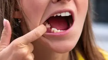 Tooth Loss Blog Thumb