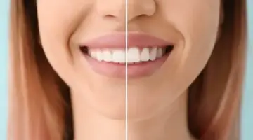 What Procedures Are Part Of Blog Thumbnail