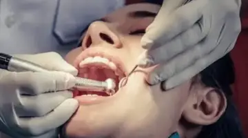 Why Choose Single Visit Root Canal Blog Thumb