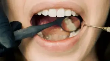 Preserving Natural Teeth Blog Thumb