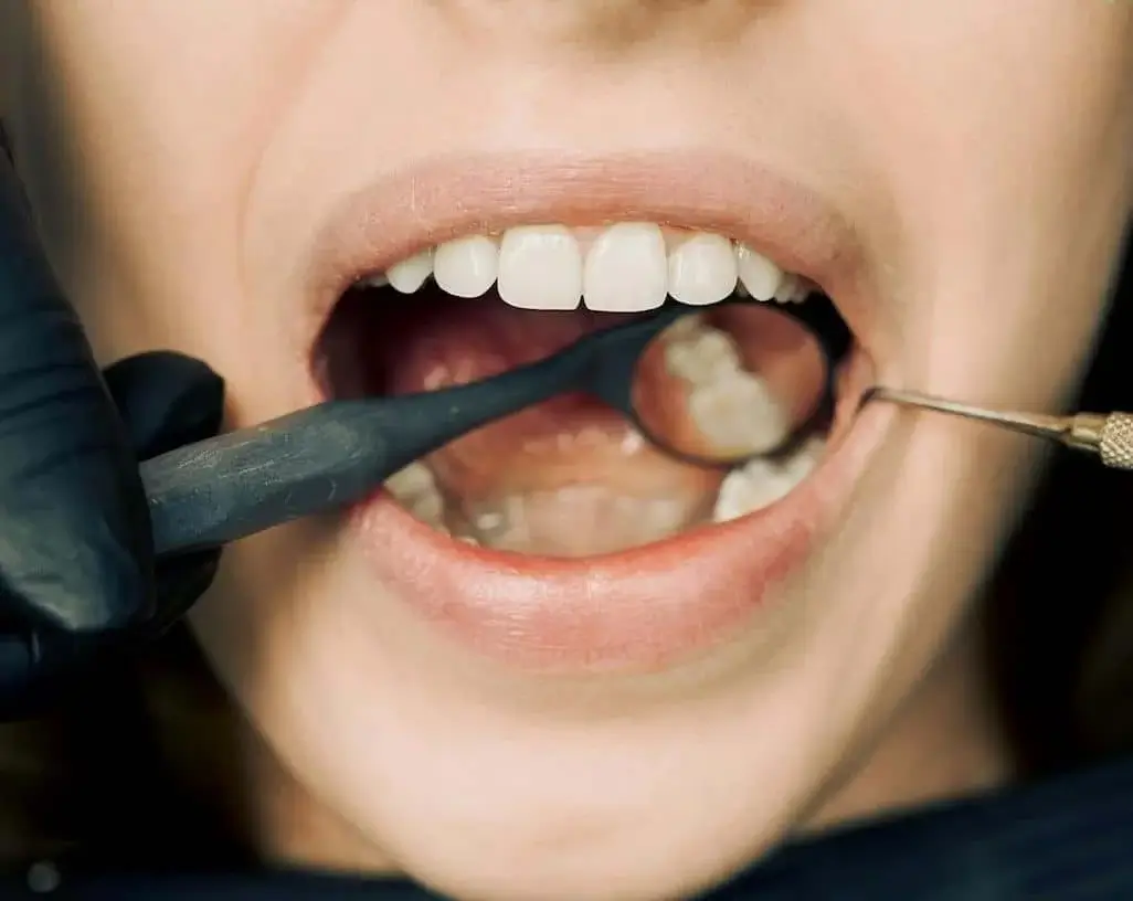 Preserving Natural Teeth Blog Thumb