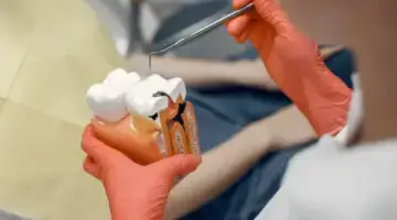 Root Canal Cost In Delhi Blog Thumb