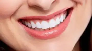 Smile Makeover And Root Canal Blog Thumb