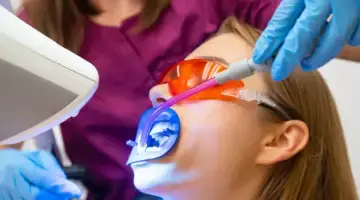 Teeth Whitening And The Dental Clock Photo