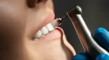 What Is The Dental Clock Photo