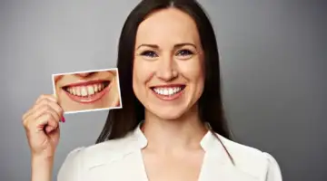 Why Do Smiles Age Blog Thumb