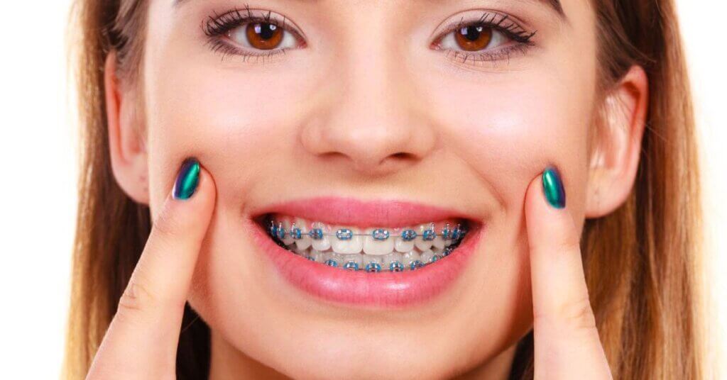 How Do Orthodontists Adjust Braces During Treatment