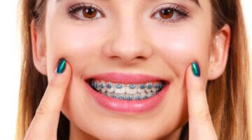 How Do Orthodontists Adjust Braces During Treatment