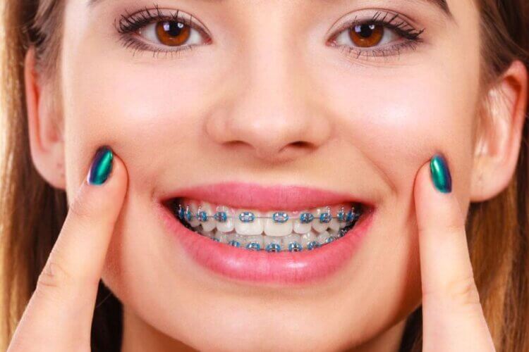 How Do Orthodontists Adjust Braces During Treatment