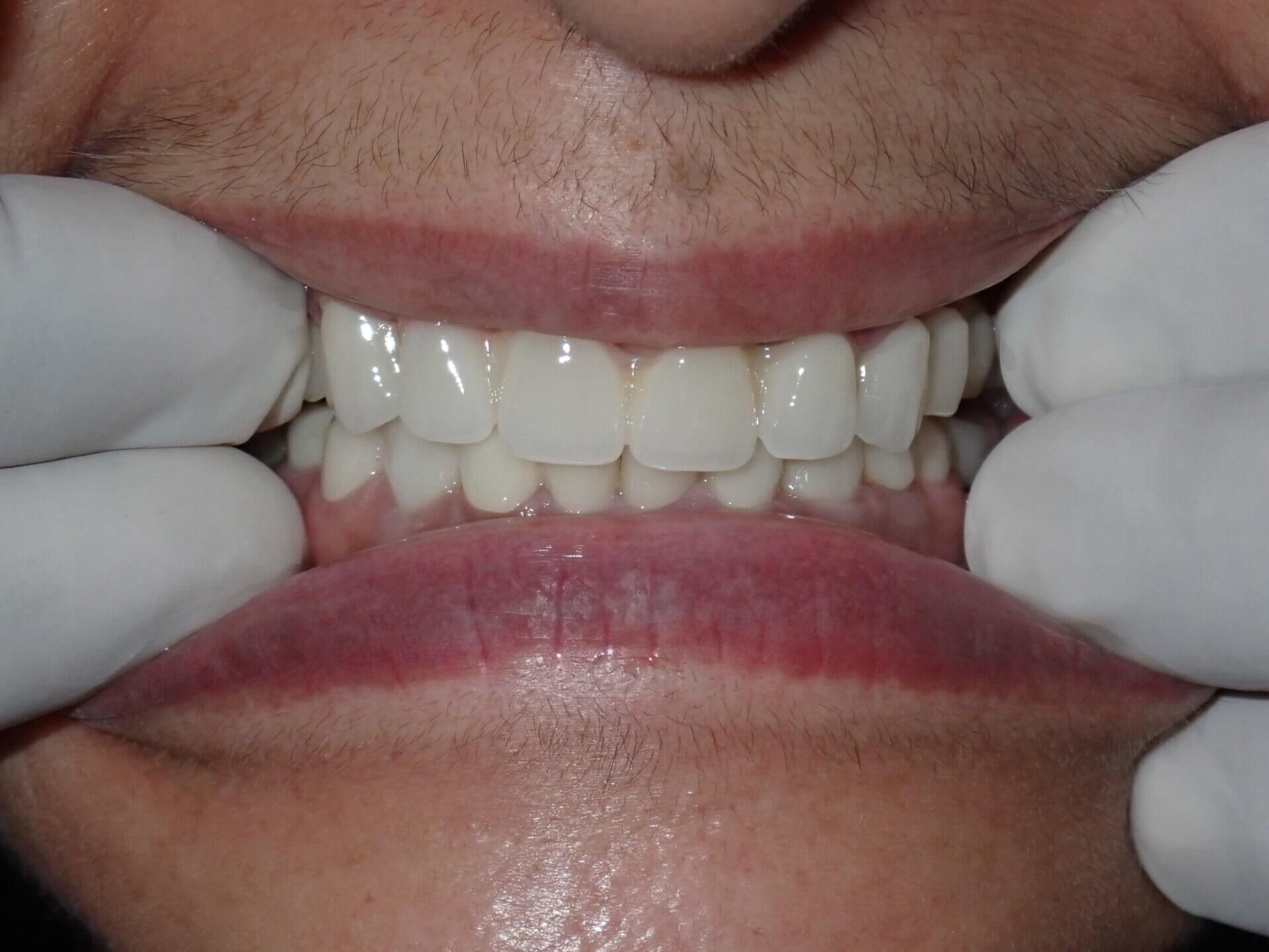 Sushma Sethi India Post Treatment1 20240907