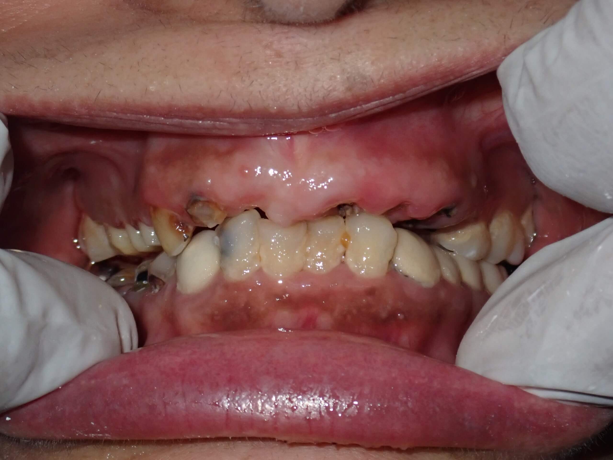 Sushma Sethi India Pre Treatment 20240806