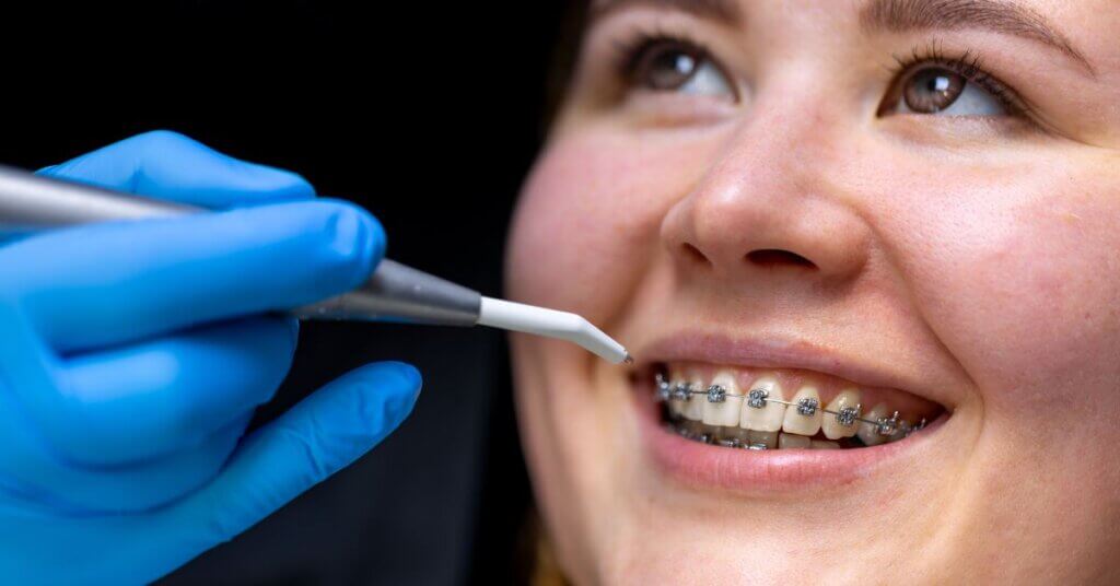 Braces