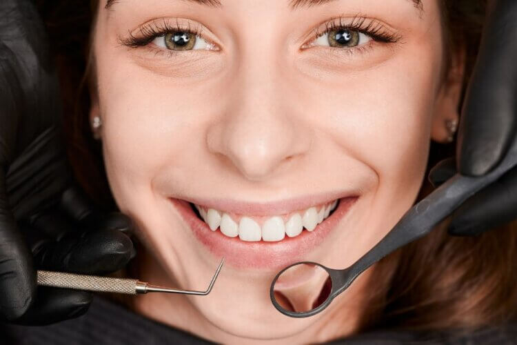 Ceramic Veneers