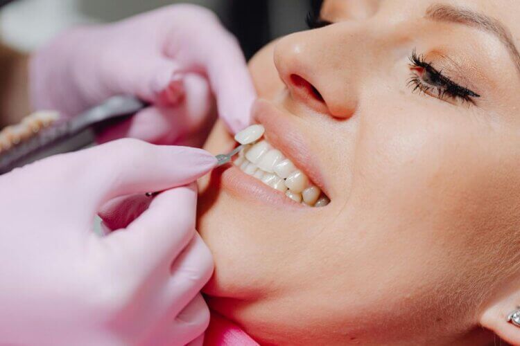 Can Ceramic Veneers Improve Uneven Tooth Shapes