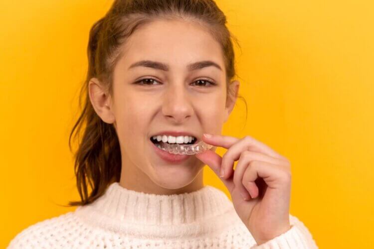 Can Invisalign Help Fix Mild Overbites In Adults