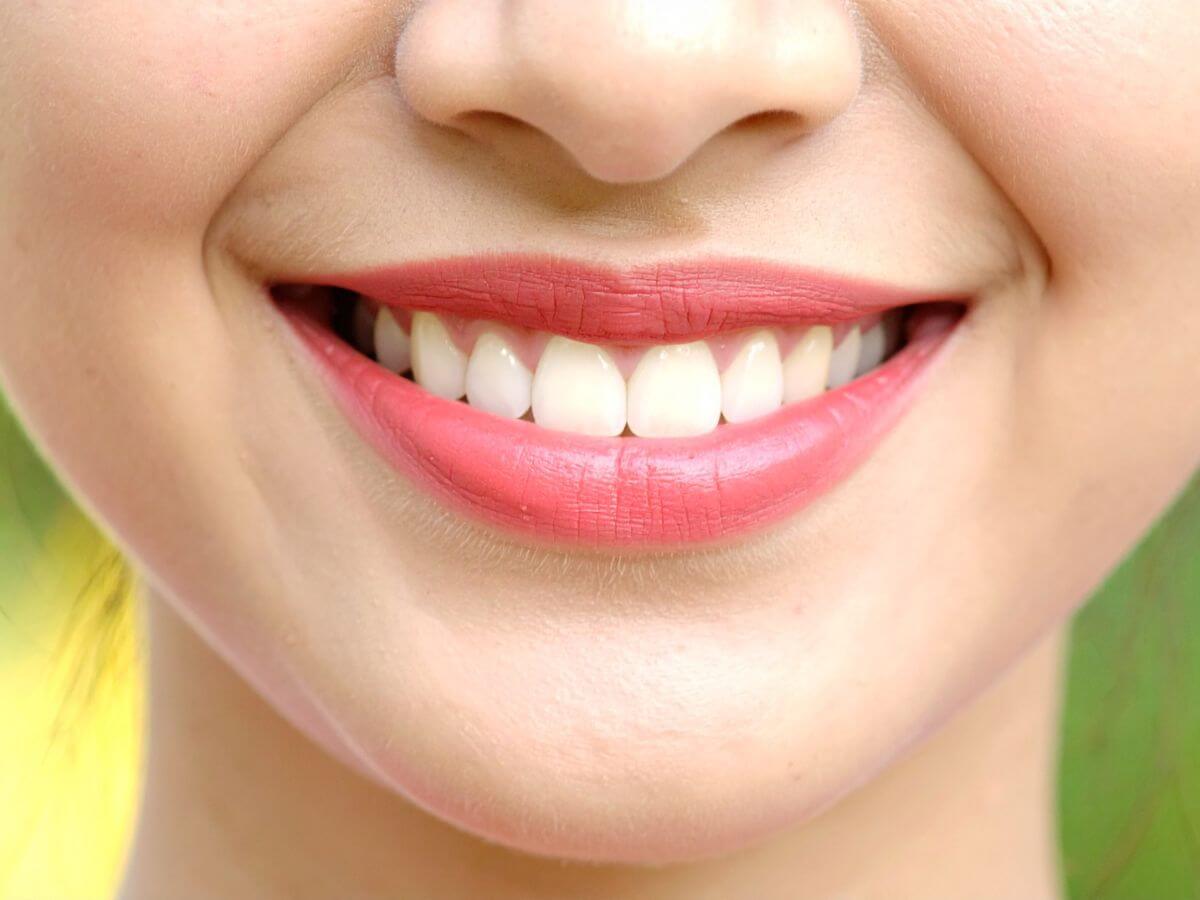 Smile Makeover 