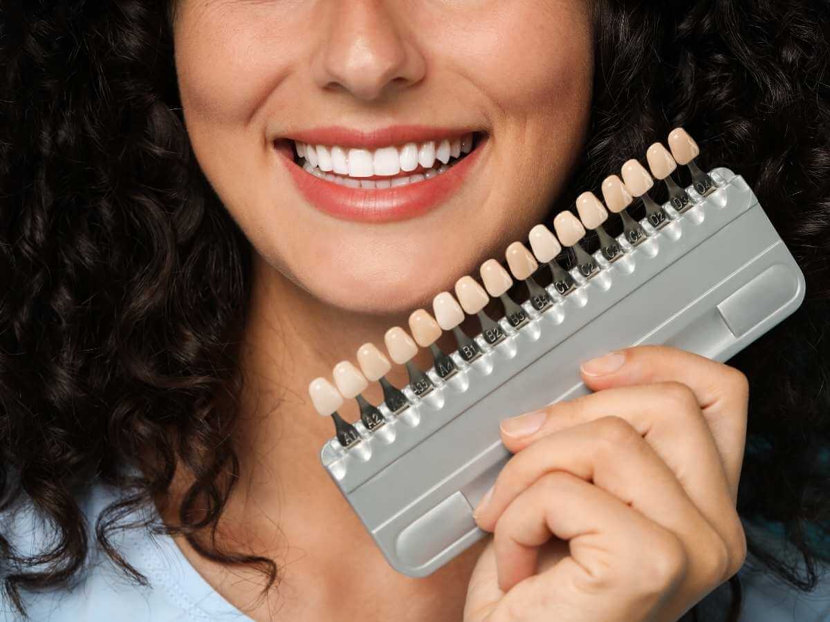 Ceramic Veneers