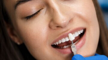 What Makes An Emax Veneer Look Like A Real Tooth?