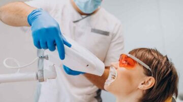 How Often Can You Repeat Professional Teeth Whitening