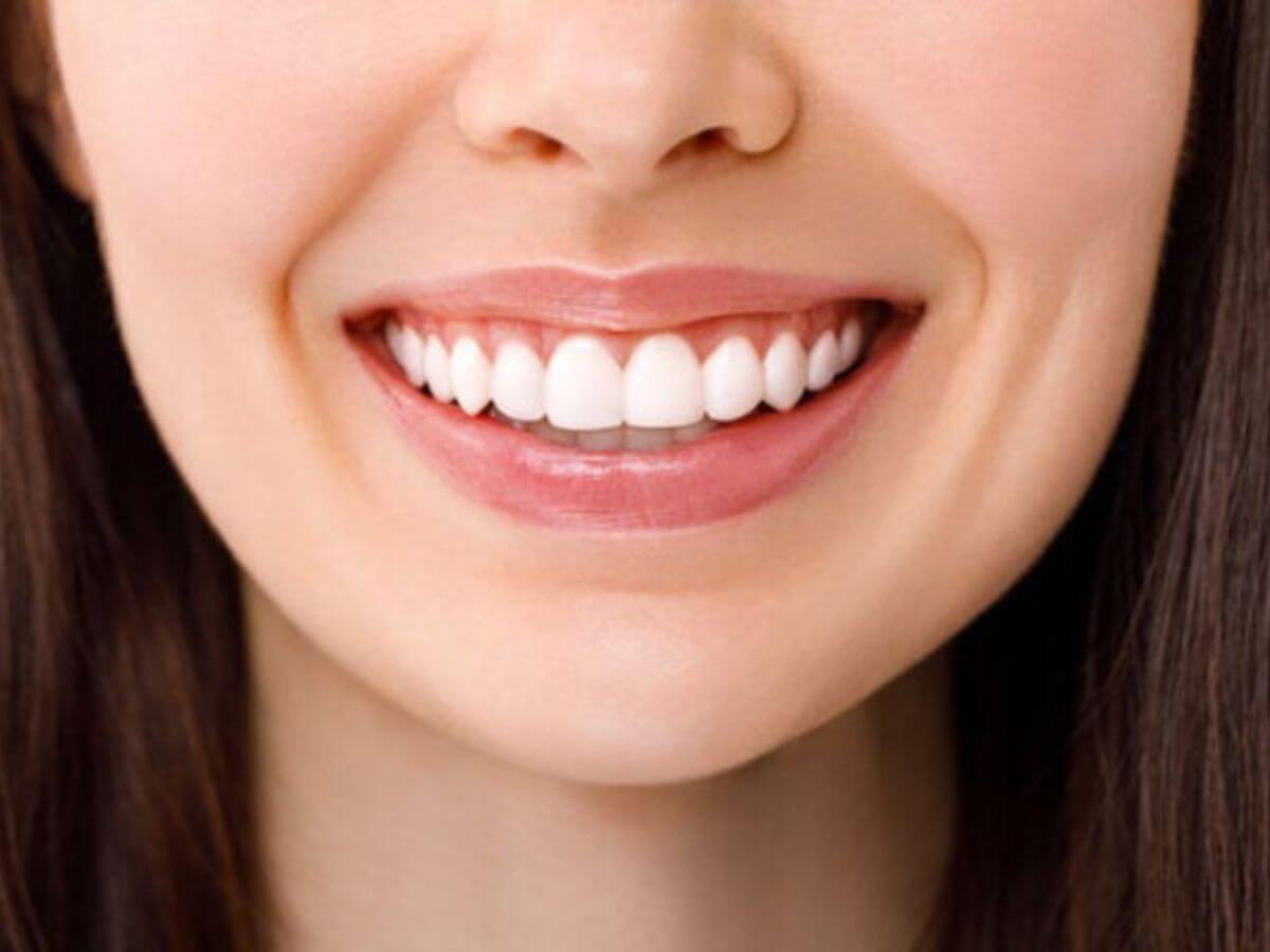 Teeth Whitening