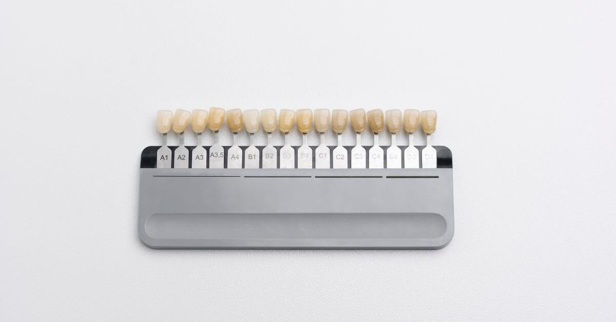 Ceramic Crowns